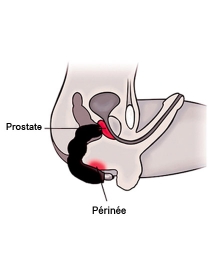 stimulateur-prostate-vibrant-promo-22.jpg